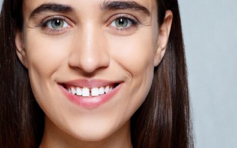 5 Faktor Penyebab Diastema, Kondisi Timbulnya Celah di Antara Gigi