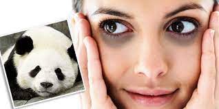 Cara menghilangkan mata panda secara alami dan cepat | merdeka.com